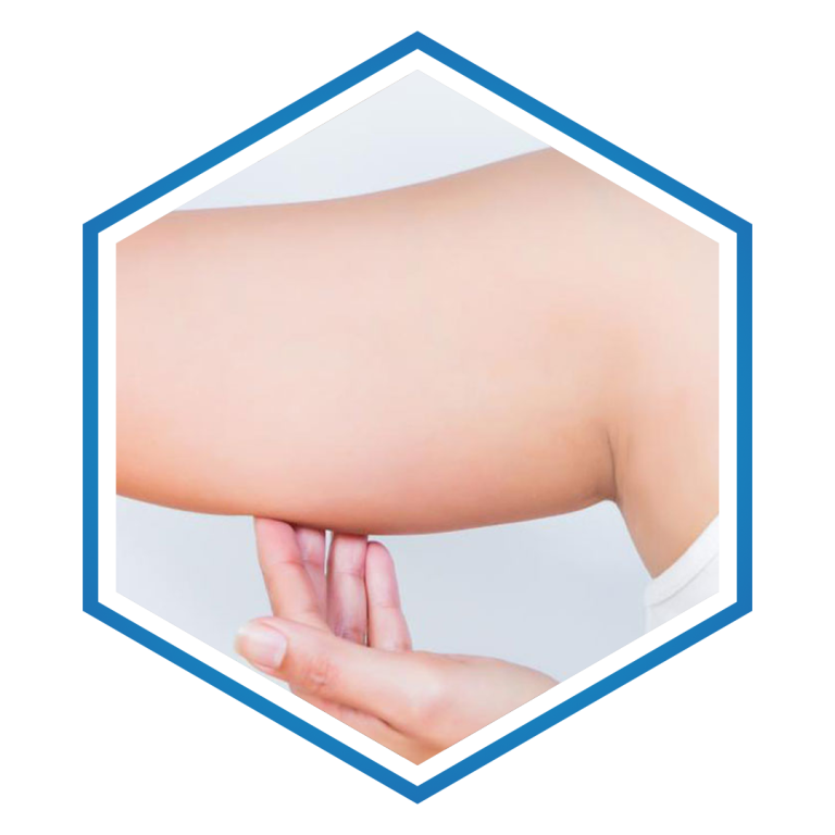 Arm lift Medical tourism in Turkey