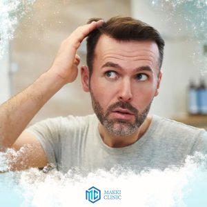 Treatment of swelling after hair transplantation